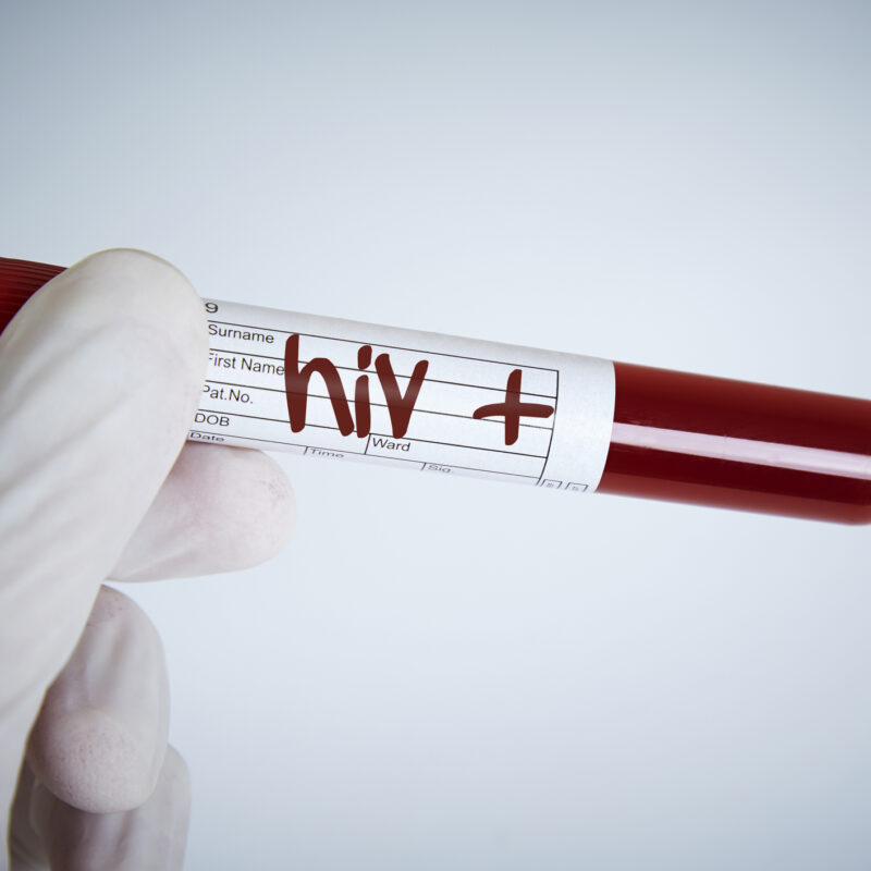 HIV: é preciso se prevenir