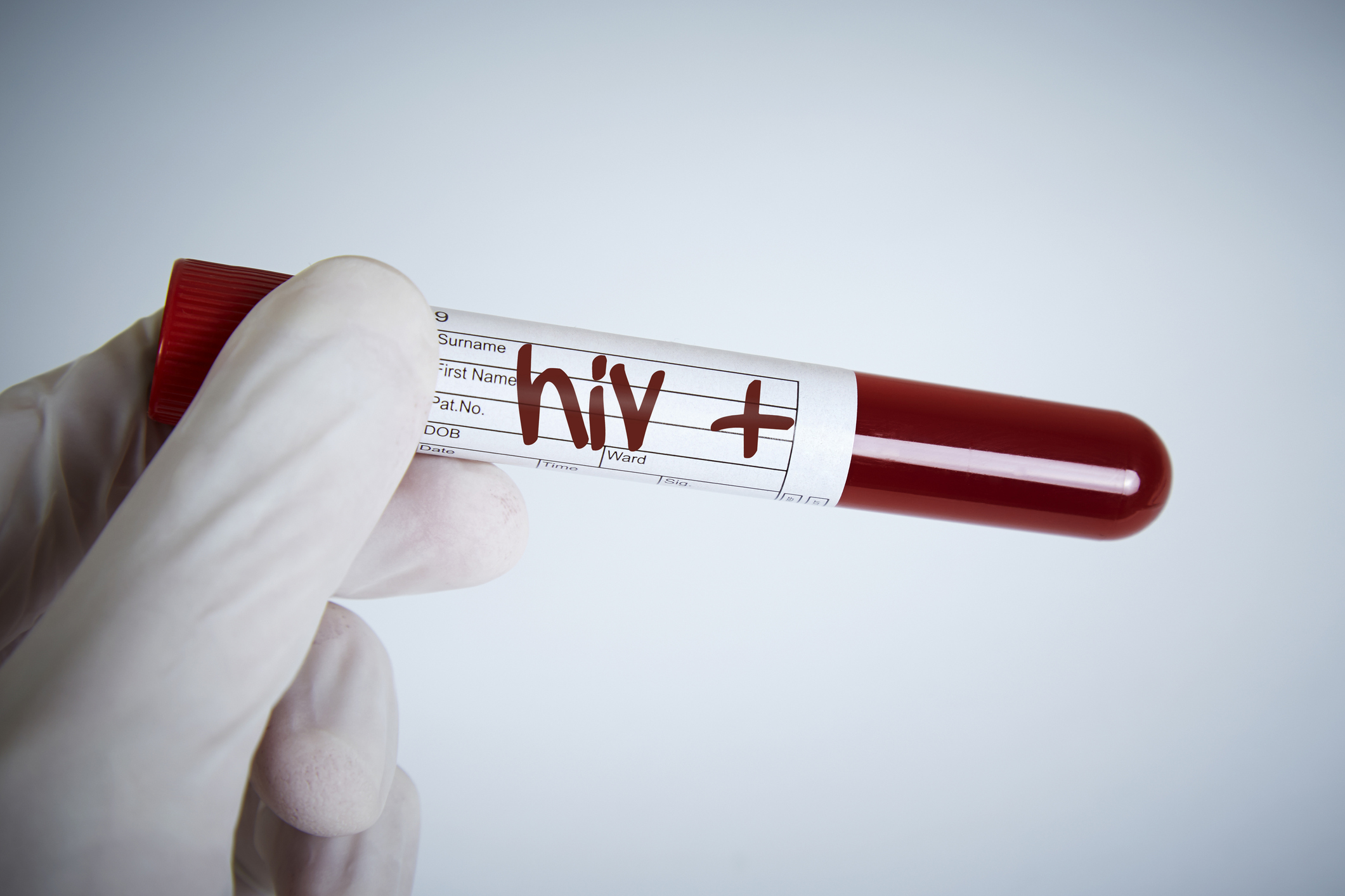 HIV: é preciso se prevenir