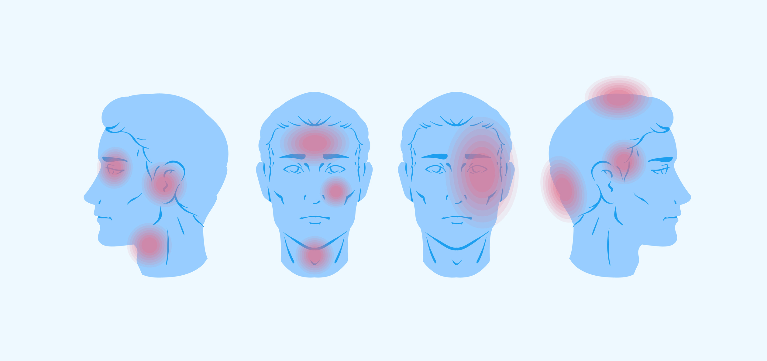  Quais são os sintomas da enxaqueca?